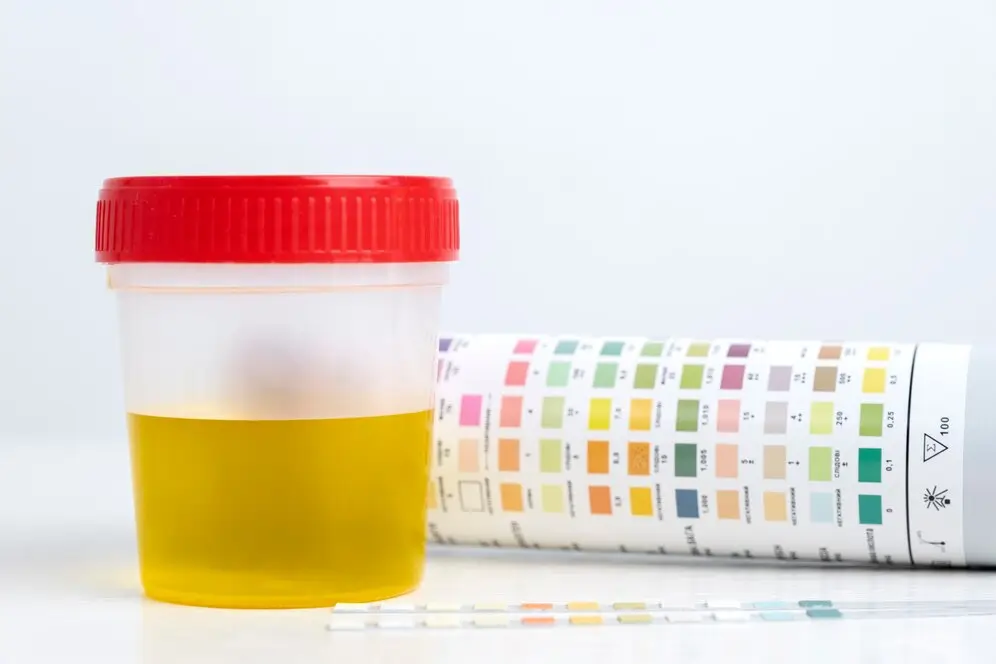 Urine for Drug Test