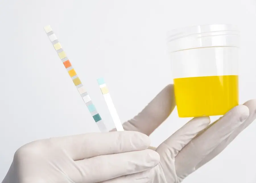 Urine Ketone